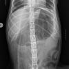 Valko Petros Oural Abdomen VD